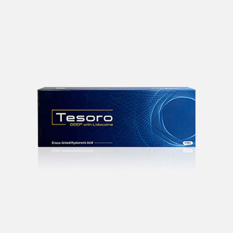 Tesoro Lido